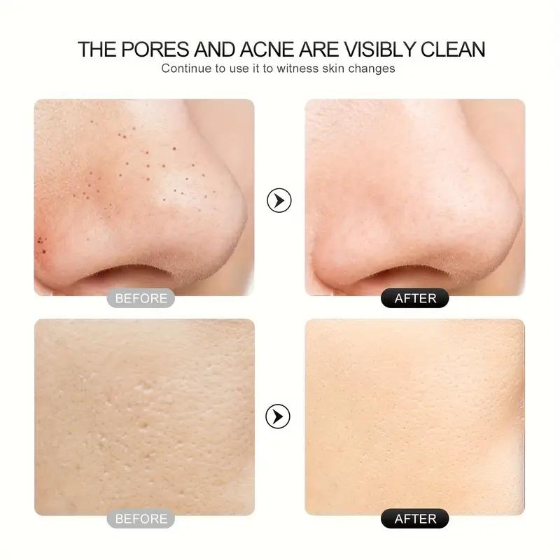 Face Scrubber Skin Spatula -Blackhead Remover With 4 Modes, Pore Extractor Face Spatula Deep Cleansing For Facial Skin Care Women Gift