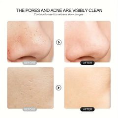 Face Scrubber Skin Spatula -Blackhead Remover With 4 Modes, Pore Extractor Face Spatula Deep Cleansing For Facial Skin Care Women Gift
